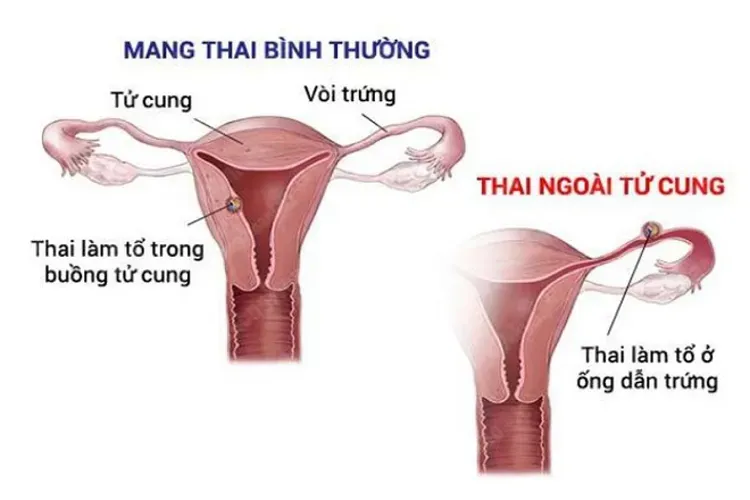 11 biểu hiện có thai sớm nhất và những dấu hiệu nguy hiểm bạn cần lưu ý