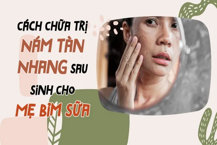 7 cách chữa tàn nhang sau sinh hiệu quả an toàn tại nhà