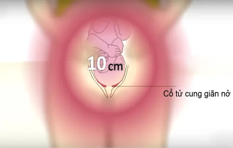 8 dấu hiệu chuyển dạ mẹ bầu dễ nhận biết nhất