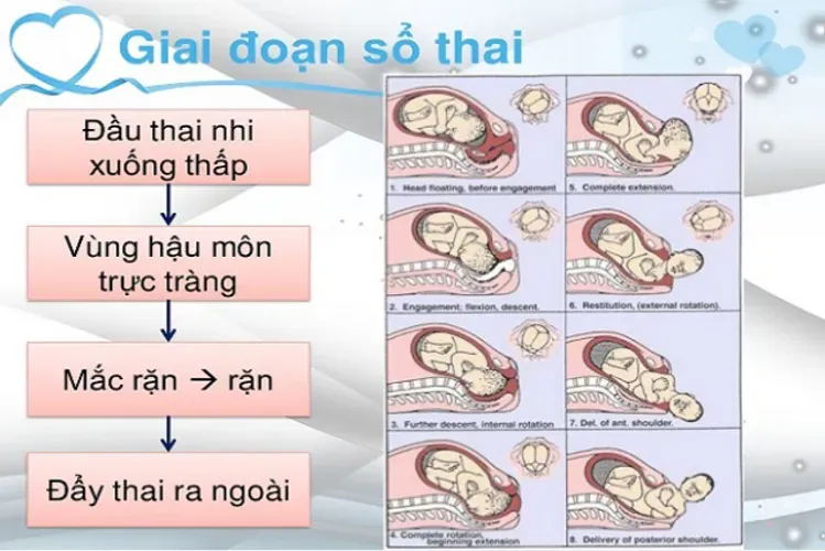 8 dấu hiệu chuyển dạ mẹ bầu dễ nhận biết nhất