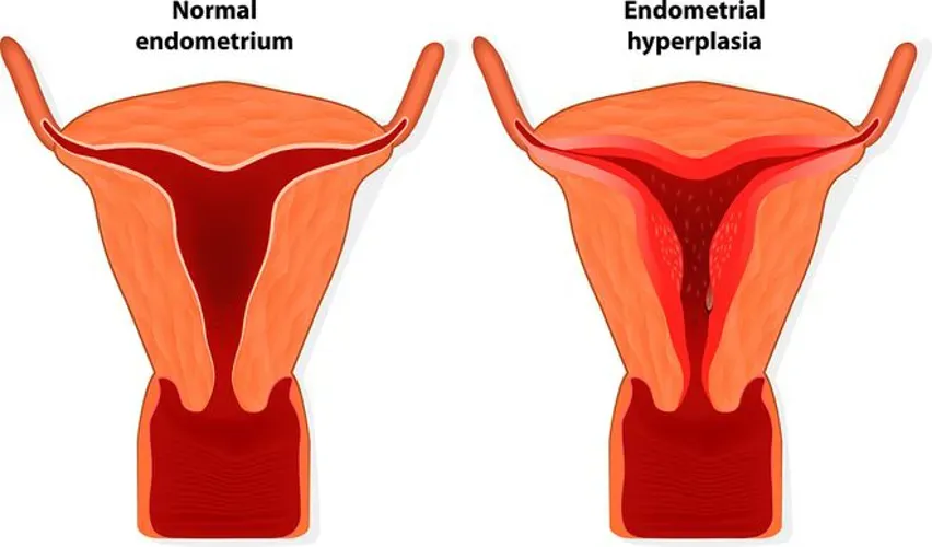 Ăn gì tốt cho trứng và niêm mạc – tại sao chị em cần chú ý đến điều này?