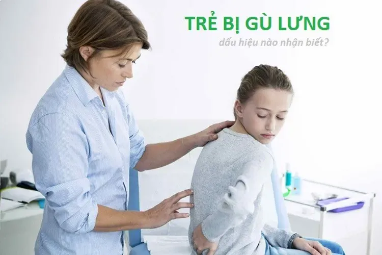 Bệnh gù lưng ở trẻ nhỏ – cách chữa trị và phòng tránh hiệu quả nhất