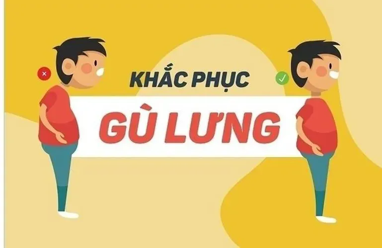 Bệnh gù lưng và kiến thức tổng quan cha mẹ cần lưu ý