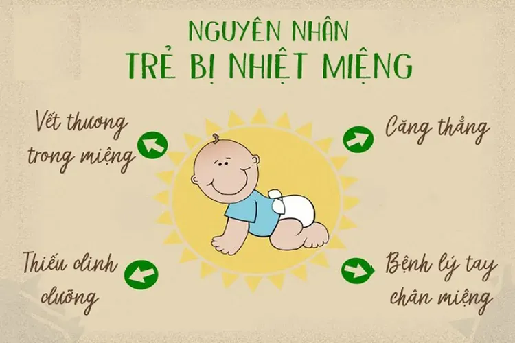 Bệnh nhiệt miệng ở trẻ em và mọi vấn đề liên quan bố mẹ nên biết