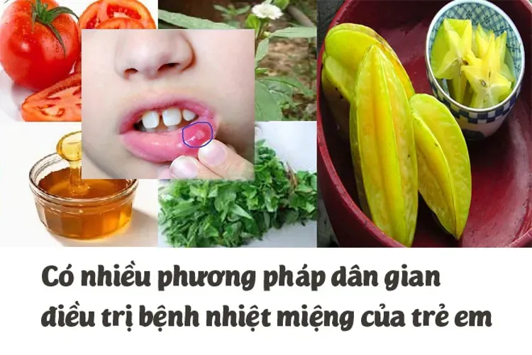 Bệnh nhiệt miệng ở trẻ em và mọi vấn đề liên quan bố mẹ nên biết