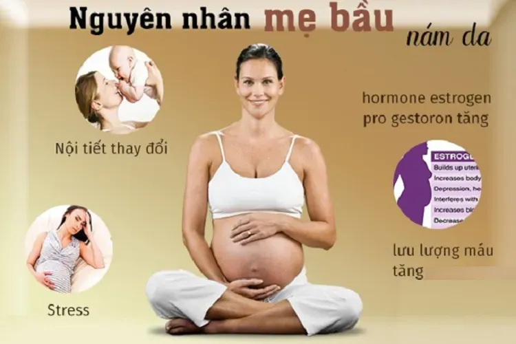 Bị nám da khi mang thai có hết không, làm sao để phòng ngừa?