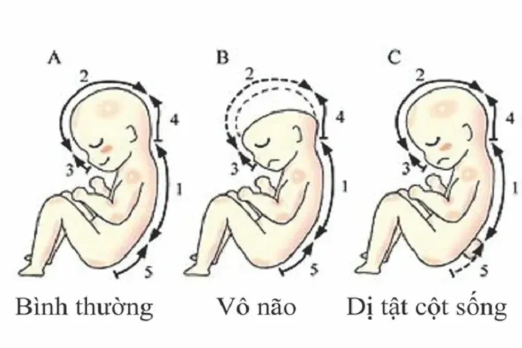 Bổ sung axit folic trước khi mang thai như thế nào mới đúng?