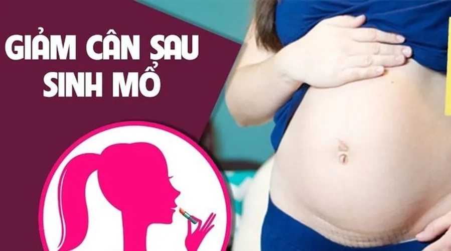 Cách lấy lại vóc dáng sau sinh mổ hiệu quả chị em hãy tham khảo ngay