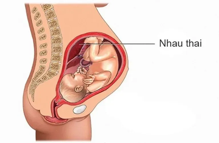 Cách phân biệt nhau bám mặt trước nhóm 1, nhóm 2 và nhóm 3