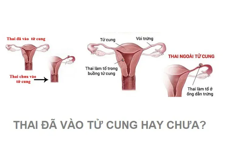 Chậm kinh bao lâu thì thai vào tử cung bạn đã biết chưa?