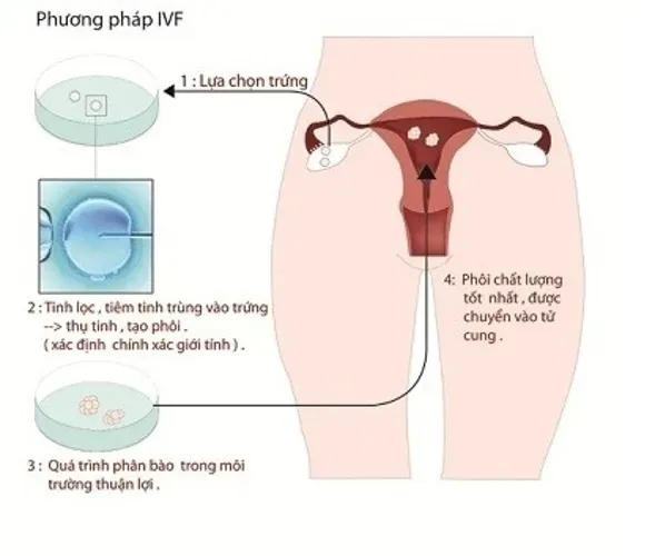 Chu kỳ rụng trứng của phụ nữ bị rối loạn – đâu là nguyên nhân và có cách nào để điều trị?