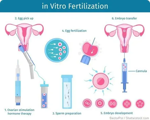 Có nên thụ tinh ống nghiệm ở bệnh viện Mỹ Đức không?