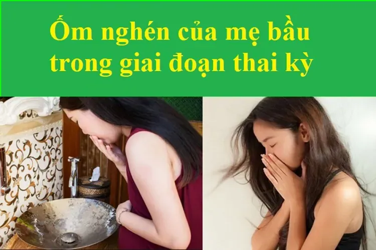 Có thai bao lâu thì bị ốm nghén – Mẹ bầu đã biết chưa?