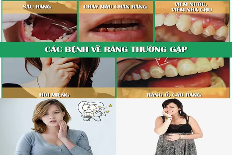 Có thai đi làm răng được không – Lời giải đáp cho bà bầu