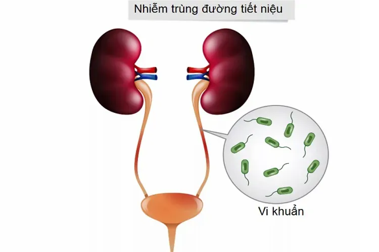 Đau bụng dưới có phải mang thai hay là do những bệnh lý khác?