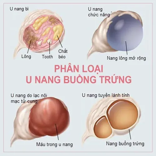 Đau bụng khi mang thai – những trường hợp mẹ cần đặc biệt chú ý