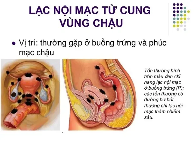 Dấu hiệu mang thai có đau bụng dưới không và lời giải đáp của chuyên gia