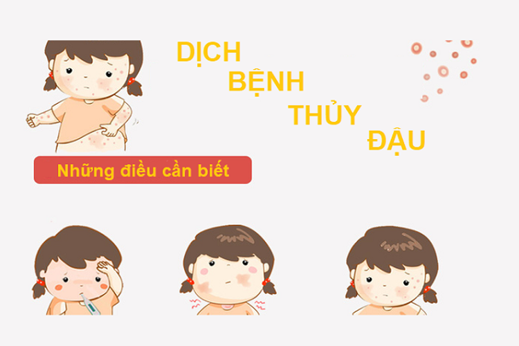 Dịch bệnh mùa hè – Đi tìm nguyên nhân, cách phòng tránh và tuyên truyền hiệu quả