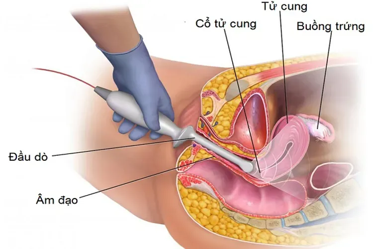 Đo độ mờ da gáy và cách đọc những chỉ số xét nghiệm mẹ cần biết