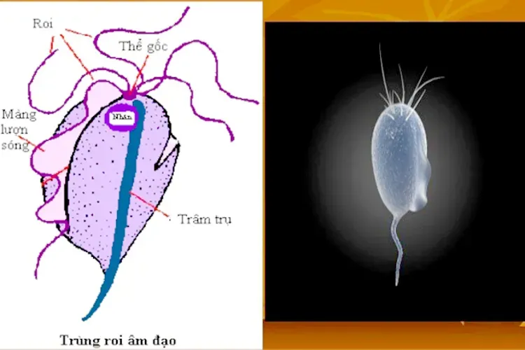 Huyết trắng ra nhiều là bệnh gì và có nguy hiểm không