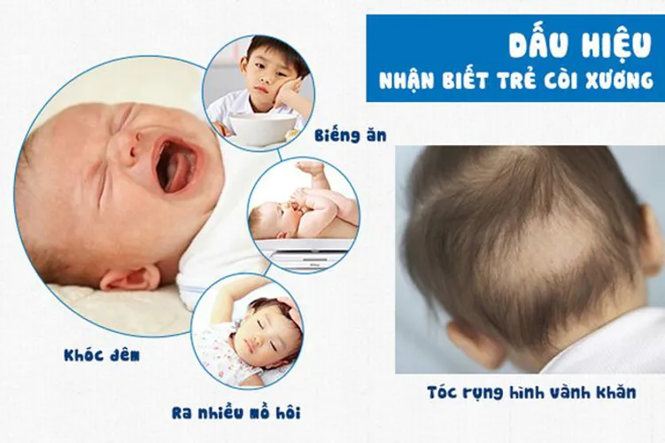 Lý do bé 8 tháng chưa mọc răng mẹ nên lưu ý