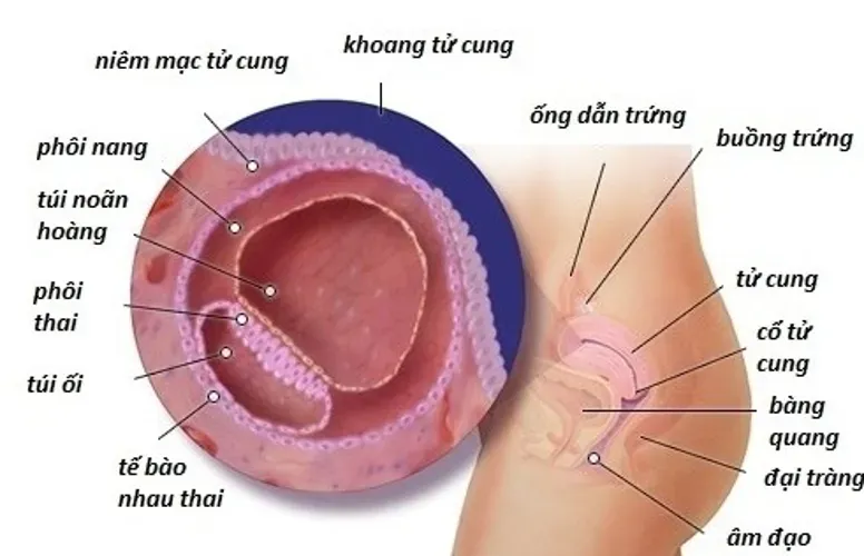 Niêm mạc tử cung dày bao nhiêu thì có thai và hướng điều trị niêm mạc tử cung bất thường để có con