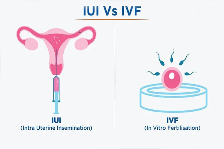 Phân biệt biện pháp thụ tinh nhân tạo và thụ tinh trong ống nghiệm, các cặp đôi nên nắm rõ