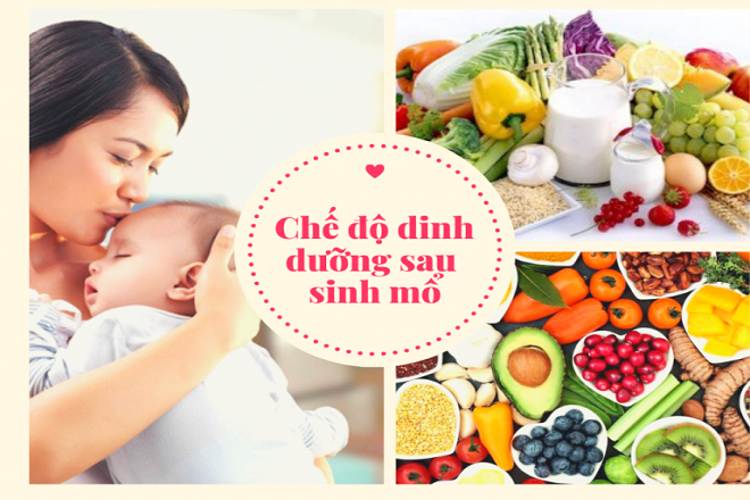 Sinh mổ và tổng hợp những thông tin cần thiết nhất cho mẹ