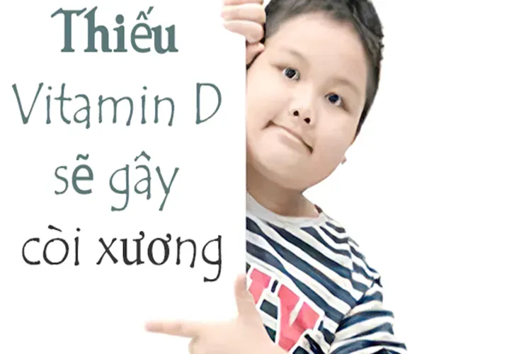 Tại sao thiếu vitamin D lại gây còi xương – một vấn đề quan trọng các cha mẹ nên lưu tâm