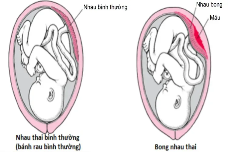 Thai 26 tuần với những thay đổi bất ngờ của mẹ và bé