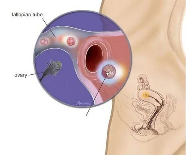 Thai 3 tuần tuổi siêu âm có thấy không?