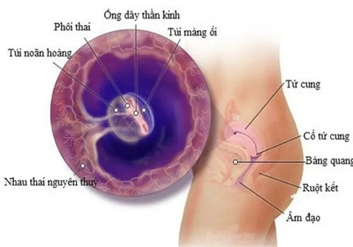 Thai có yolksac là gì và có nguy hiểm không?