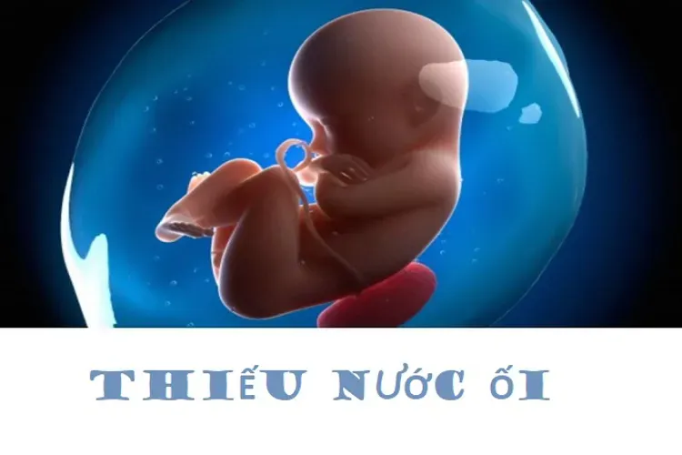 Thiếu nước ối – tình trạng bất thường của thai nhi mẹ bầu nhất định phải quan tâm