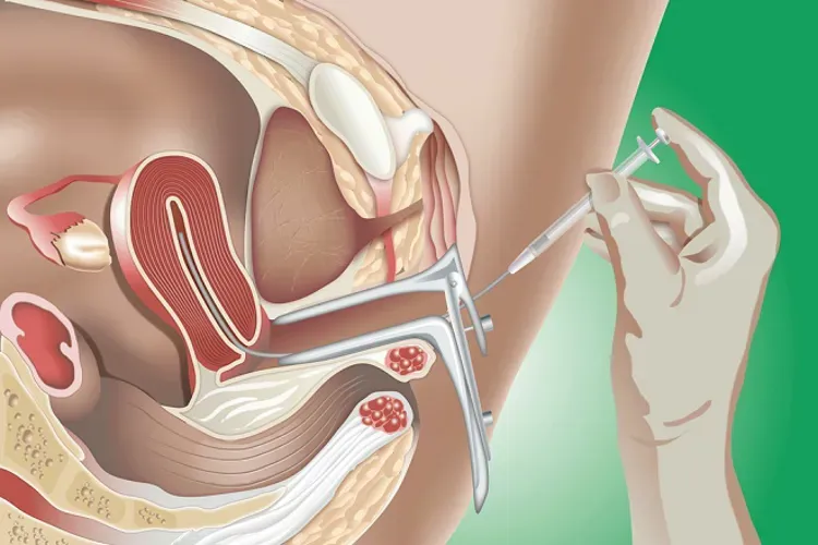 Thụ tinh nhân tạo – niềm hy vọng và món quà quý giá dành cho những cặp vợ chồng hiếm muộn