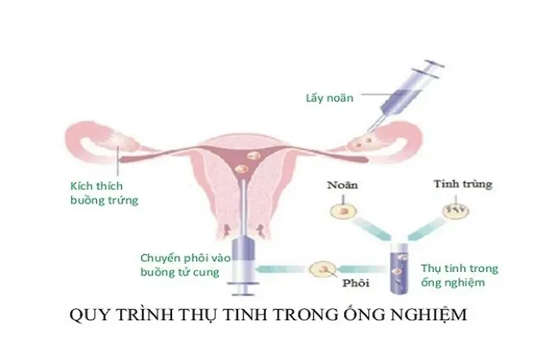 Thụ tinh ống nghiệm và các quy trình thụ tinh nhân tạo bạn cần biết