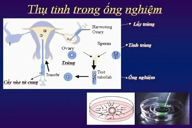 Thụ tinh trong ống nghiệm để sinh đôi có an toàn không?