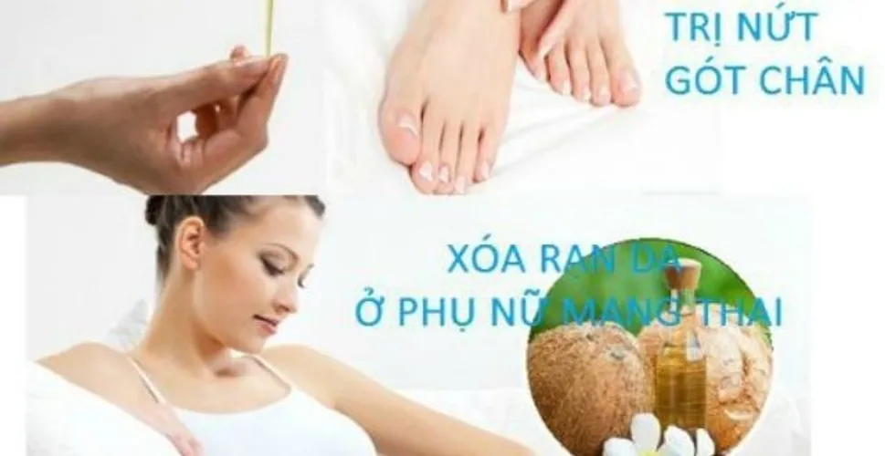 Tinh dầu dừa và 12 công dụng làm đẹp độc đáo các mẹ sau sinh nên biết !