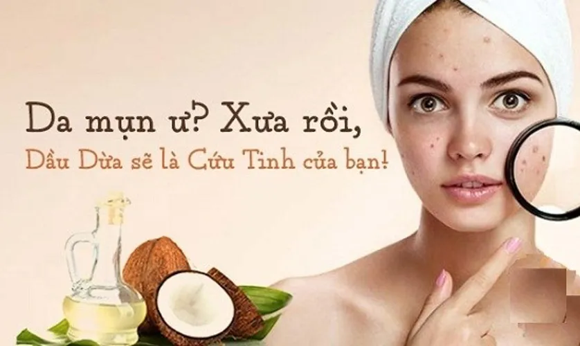 Tinh dầu dừa và 12 công dụng làm đẹp độc đáo các mẹ sau sinh nên biết !