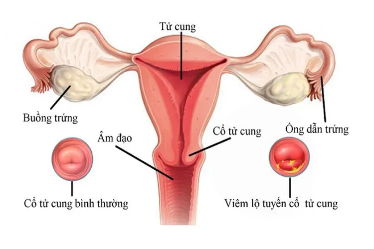 Top 7 các bệnh phụ khoa nguy hiểm mà chị em phụ nữ thường gặp