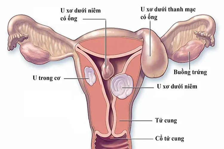 Top 7 các bệnh phụ khoa nguy hiểm mà chị em phụ nữ thường gặp