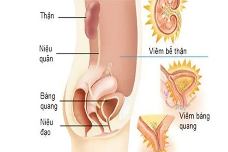 Top 7 các bệnh phụ khoa nguy hiểm mà chị em phụ nữ thường gặp