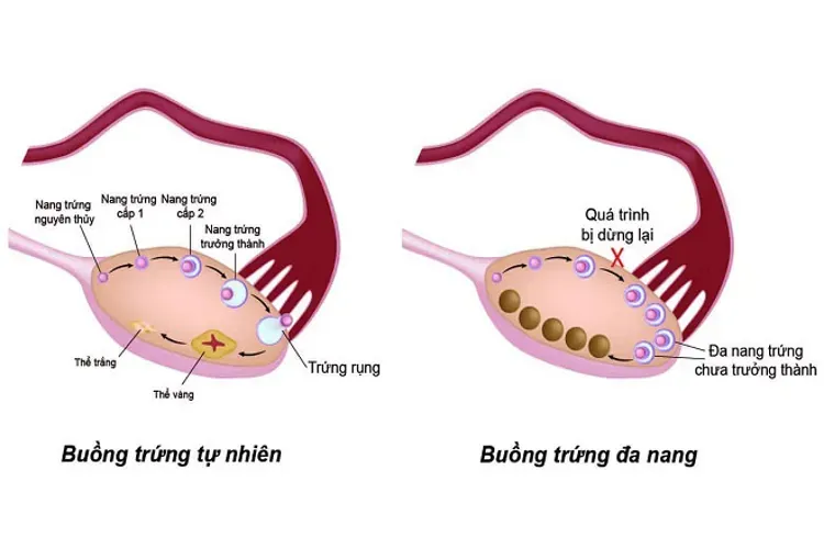 Top 7 các bệnh phụ khoa nguy hiểm mà chị em phụ nữ thường gặp